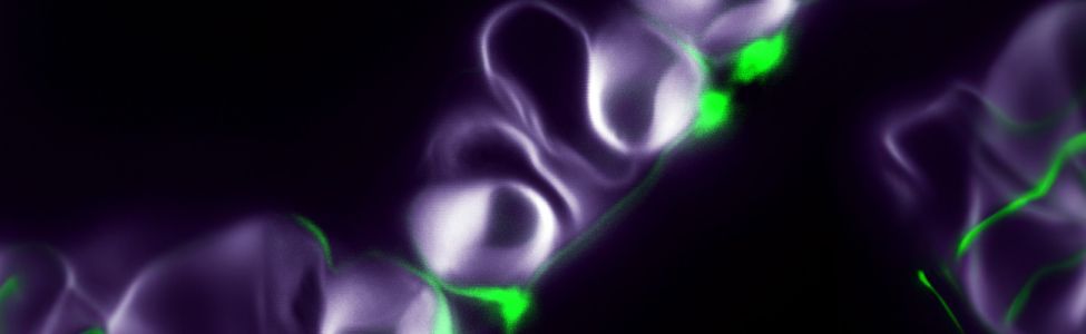 Stomates et cuticule. Blanc: Paroi primaire, Vert: Cuticule © Robertas Ursache