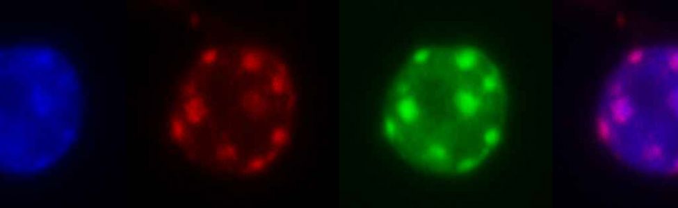 microscopie fluorescence