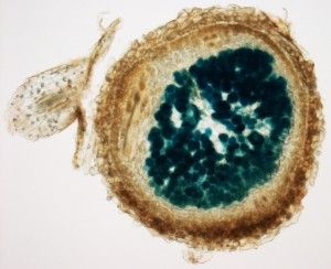Nodule