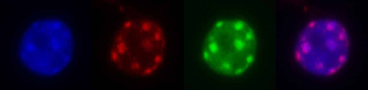 microscopie fluorescence