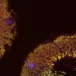 Donacia_vulgaris_symbiotic_organ © M.Kaltenpoth