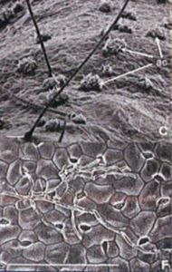 Colonisation des tissus de la plante par les filaments infectieux du parasite - C. Torregrosa & C. Jacquet