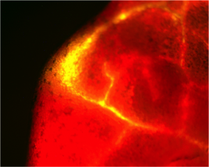 Entry of fluorescent Xanthomonas bacteria (yellow) in the hydathode of Cabbage leaf and colonization of its vasculature (©C