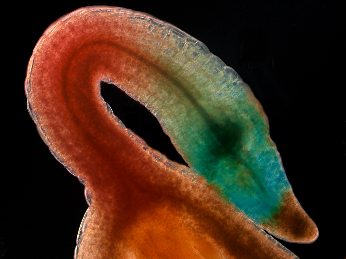 © A.Bottin - LRSV / Plateforme imagerie FRAIB