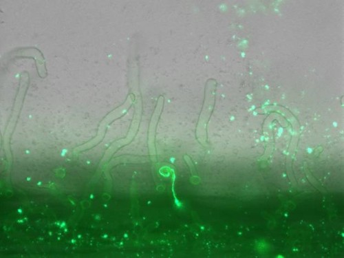 Couplage image Fond clair et fluorescence : visualisation d’un cordon d’infection dans un poil absorbant (diamètre d’un poil de 10 µm)